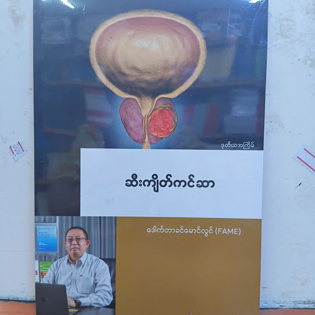 ဆီးကျိတ်ကင်ဆာ